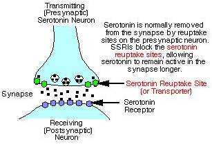 Haloperidol schizophrenia